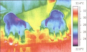 nedokrven� �l�nky prst�